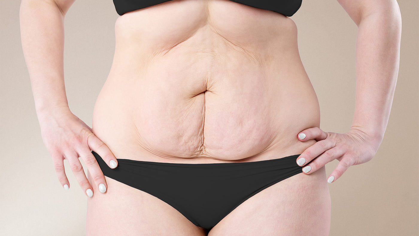 Woman's weight loss transformation with Ionix 3D Leggings