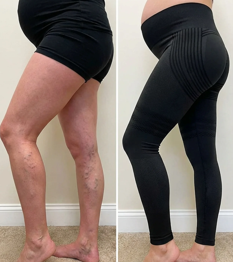 Ionix Labs 3D Sculpting Leggings — Varicose Vein Relief